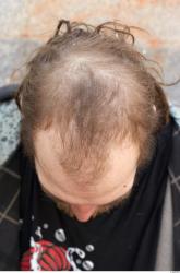 Hair Man White Average Bald